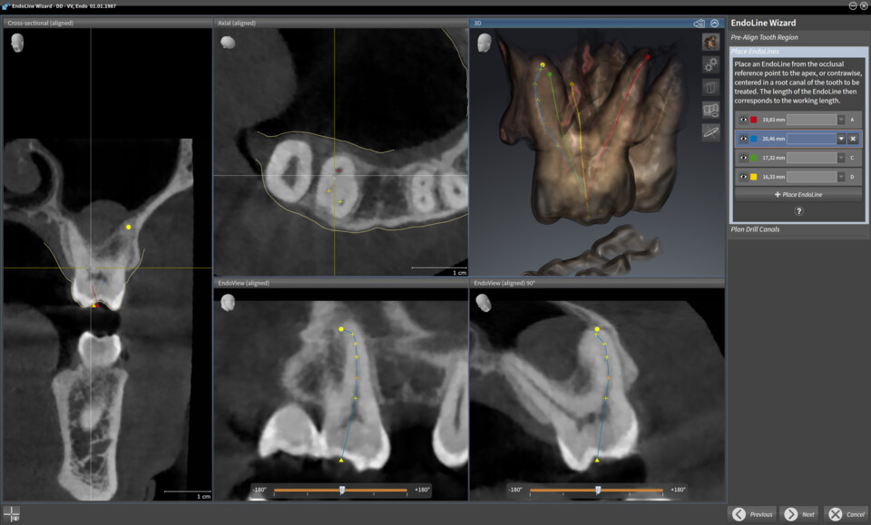 Endo Software VistaSoft Sicat Endo software for endodontics