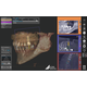 VistaSoft Module Implant & Guide VistaSoft Implant & Guide