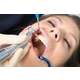 Lunos Prophy Paste application upper jaw