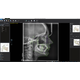 Digital cephalometric analyses with VistaSoft Trace