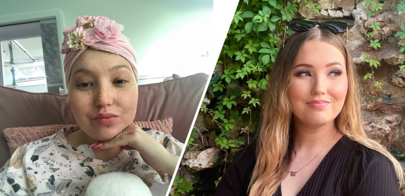 Stem Cell recipient, Sophie, before and after transaplant