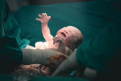 Doctor and nurse are pulling a new born baby from mom's abdomen - Concept Genesis