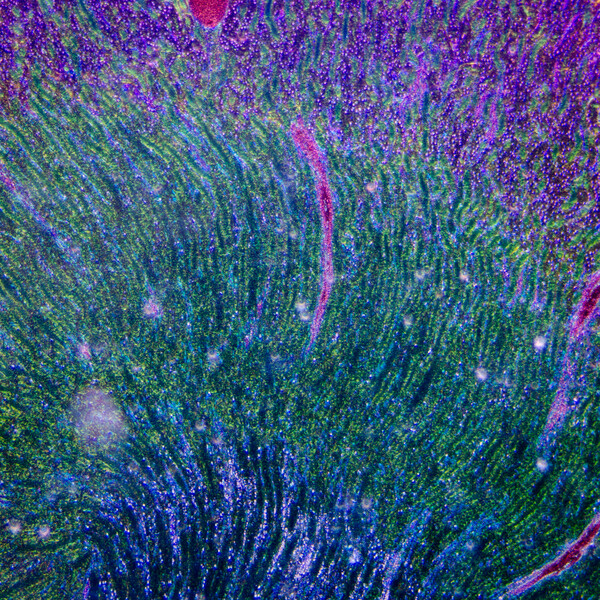 Frontiers in Nephrology