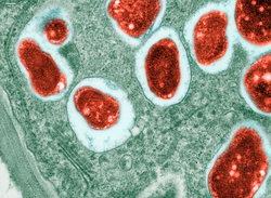Transmission electron micrograph of soy bean root