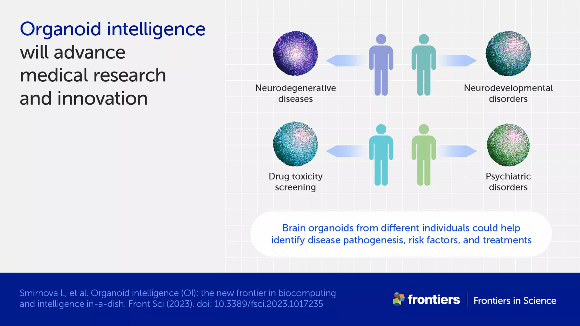 Infographic describing how brain organoids could advance research for diseases such as Alzheimer's by identifying disease pathogenesis, risk factors, and treatments