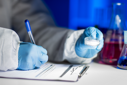 science, chemistry, medicine and people concept - close up of young scientist with chemical sample taking notes on clipboard and making test or research in laboratory