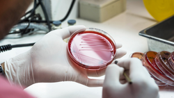 Close up the media plate on hand medical technicians working on bacterial culture and drug resistance of pathogens in laboratory.