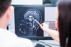 Medicine Brain checking. Doctors consider and discuss magnetic resonance image (MRI) of the brain. Tomography service. Back view, selective focus. ; Shutterstock ID 570241147; purchase_order: Bynder Library; job: ; client: ; other: