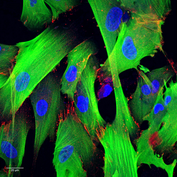 cultured human cells stained with fluorescent dyes (cardiac myofibroblasts stained for calponin in green, N-cadherin in red, and in blue for DNA)