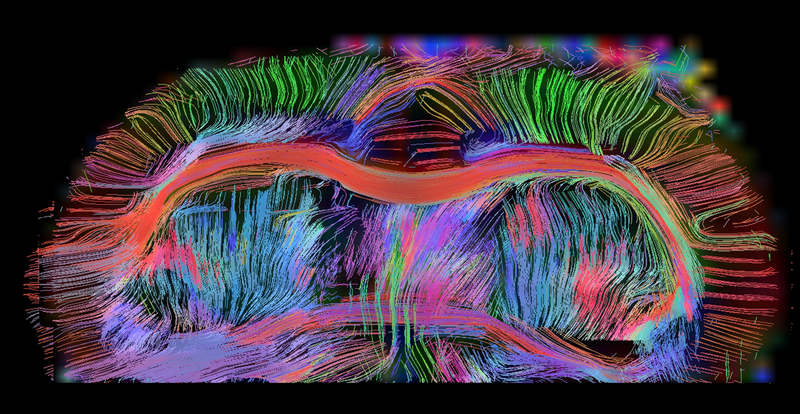 Frontiers in Neuroimaging