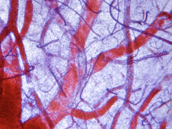 Blood vessels under microscope                                           