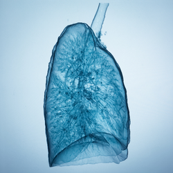 3-dimensional computed tomography (3D-CT) imaging from multidetector CT images 