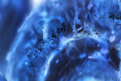 cancer cells under a microscope. Tissues affected by cancer cells under the microscope, Science. Cancer drugs. chemistry and biology.