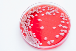 bacterial culture of Staphylococcus Colonies / bacteria gram negative bacilli./ Gram negative cocci bacilli on blood agar.