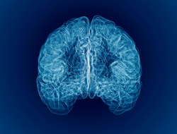 Pain in the head, brain and synapses, cognitive problems, mental deficit. Aneurysm. Degenerative diseases affecting the brain area. Parkinson and Alzheimer. 3d render