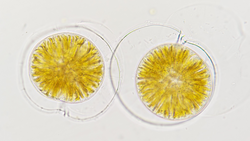 Live cells of marine dinoflagellates called Pyrophacus sp. 400x magnification with selective focus
