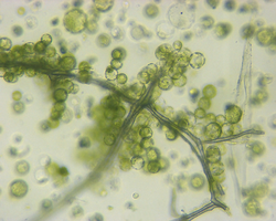 CRISPR Genome editing plant cells(protoplast) used for coronavirus vaccine.