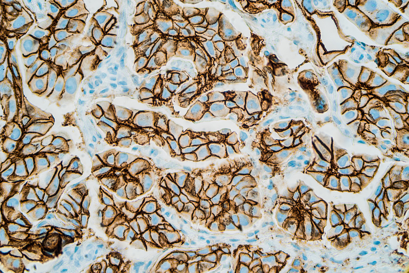 Pathology and Oncology Research