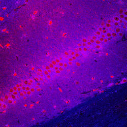 Life pattern of neurons in the mouse hippocampus