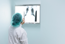 Woman doctor looking patient chest x-ray film before treatment.Image lung at radiology department in hospital.