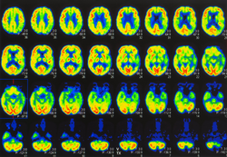 an array of positron emission tomography or PET images showing many phases of brain perfusion function and activity