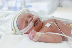 premature baby in incubator